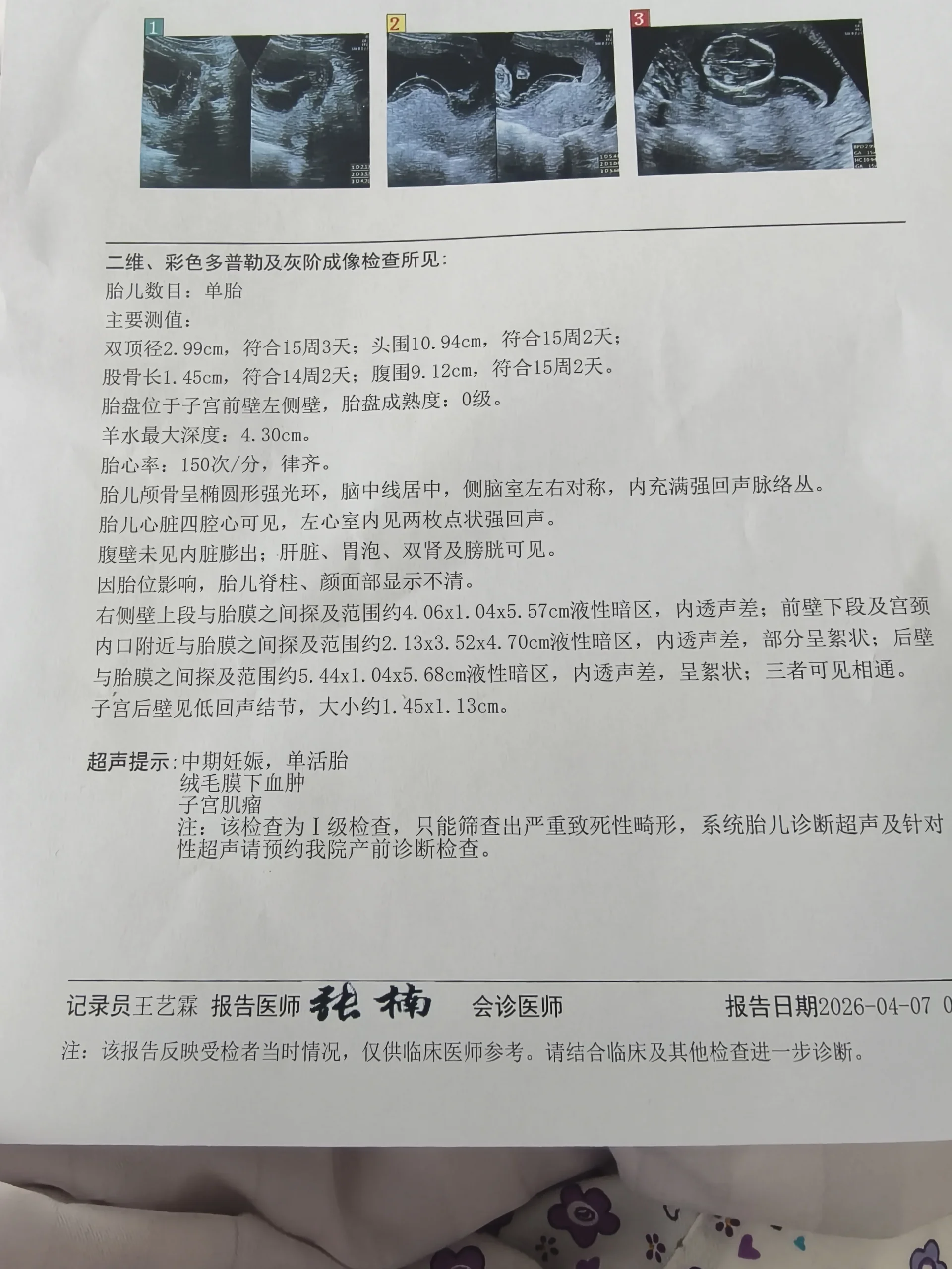 4月7日产检报告