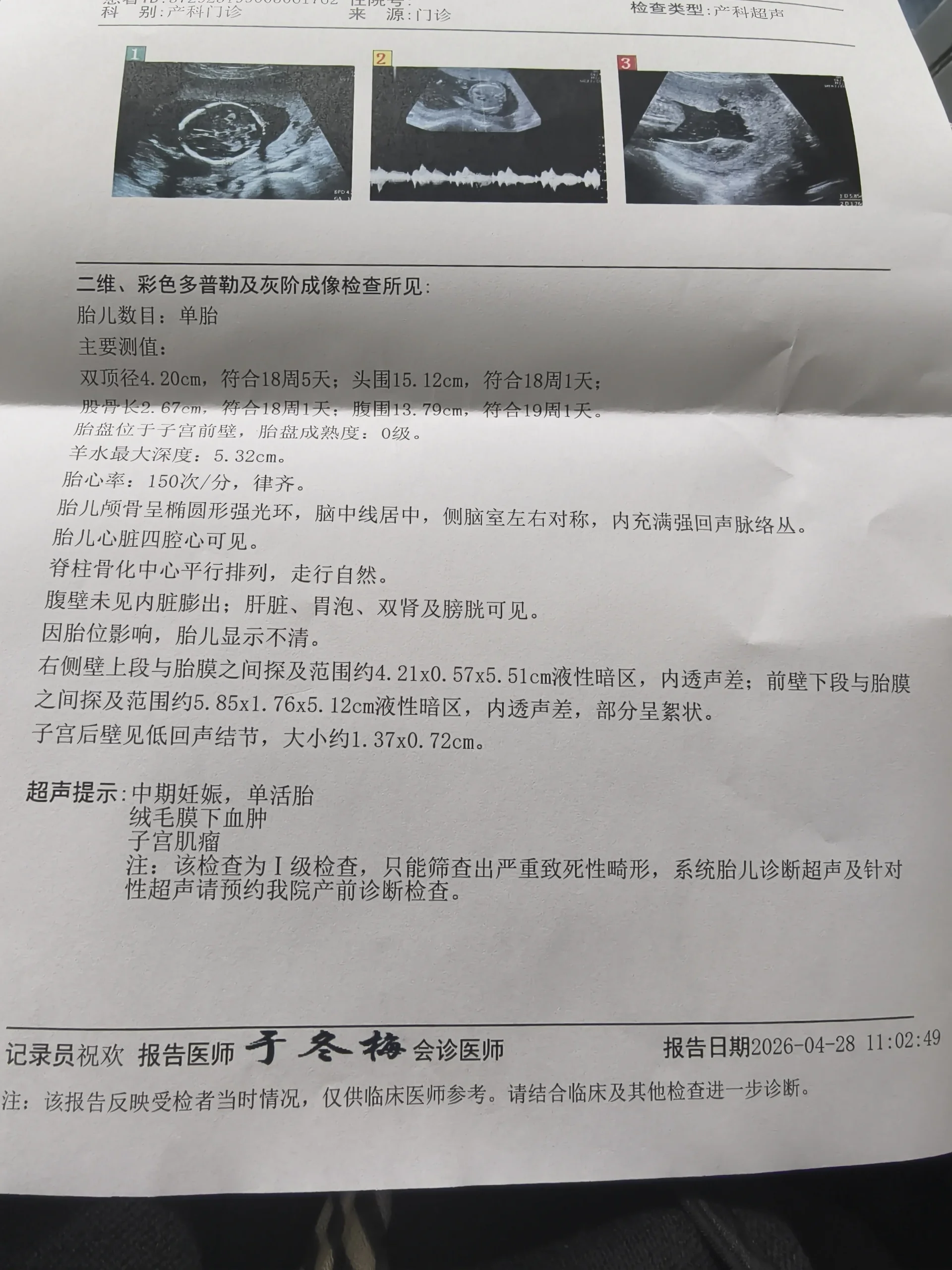 4月28日产检报告